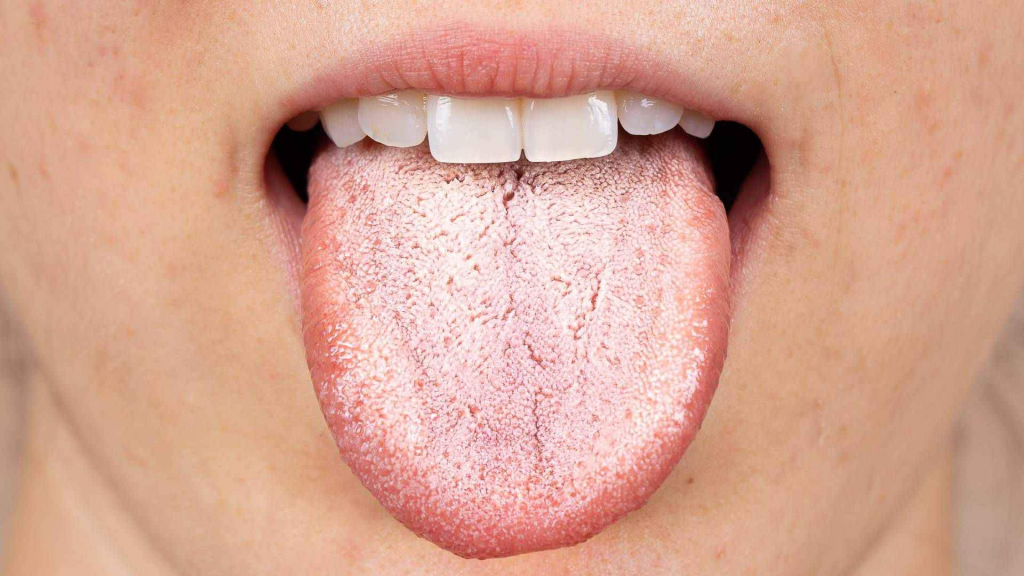 What Is Vapers Tongue - Cloudstix UK